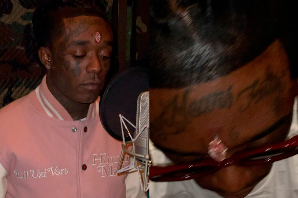  Image of US rapper, Lil Uzi Vert embeds $24 million 11-carat pink diamond in his forehead (photos)