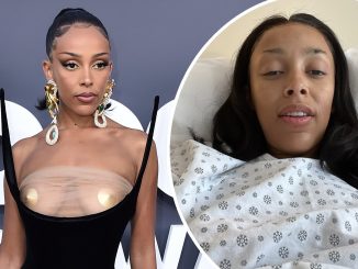 Rapper Doja Cat shares photos after her breast reduction and liposuction surgery